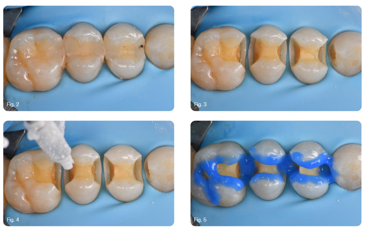 Katana Cleaner Demonstration